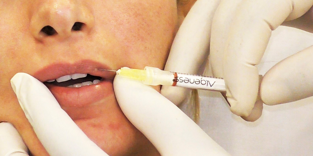 Training in Lip Fillers at Aesthetic Academy Asia